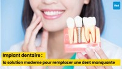 Implant dentaire : la solution moderne pour remplacer une dent manquante