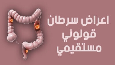 اعراض سرطان قولوني مستقيمي