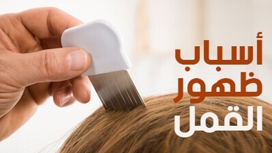 أسباب ظهور القمل