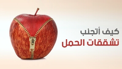 كيف أتجنب تشققات الحمل