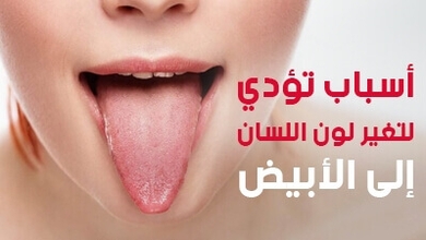 أسباب تؤدي لتغير لون اللسان إلى الأبيض
