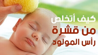 كيف أتخلص من قشرة رأس المولود
