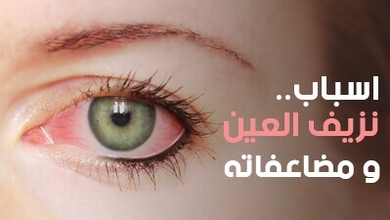 اسباب نزيف العين .. و مضاعفاته