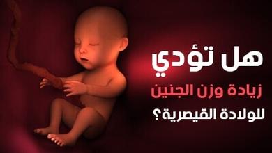 هل تؤدي زيادة وزن الجنين للولادة القيصرية؟