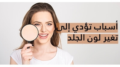 أسباب تؤدي إلى تغير لون الجلد وكيفية التعامل معها