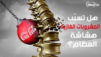 هل تسبّب المشروبات الغازية هشاشة العظام؟