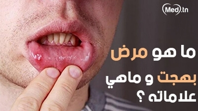 ماهو مرض بهجت و ماهي علاماته ؟