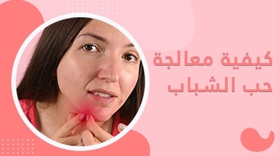 كيفية معالجة حب الشباب