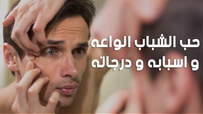 حب الشباب انواعه و اسبابه و درجاته