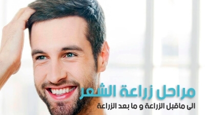 مراحل زراعة الشعر