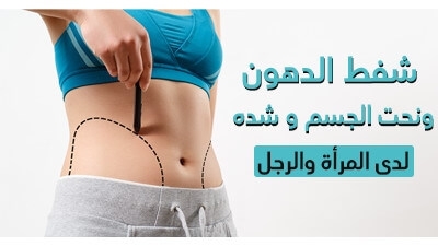 شفط الدّهون ونحت الجسم و شدّه لدى المرأة والرّجل