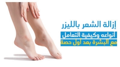 إزالة الشّعر باللّيزر : أنواعه وكيفيّة التّعامل مع البشرة بعد أوّل حصّة