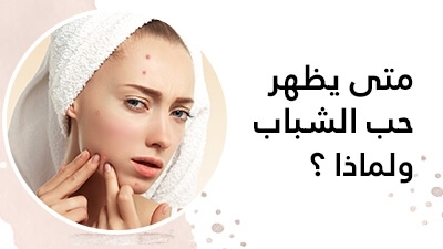 متى يظهر حبّ الشّباب ولماذا ؟ 