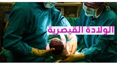 الولادة القيصرية 