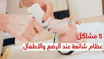 5 مشاكل عظام شائعة عند الرضع والأطفال