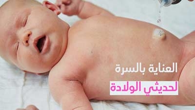 العناية بالسرة لحديثي الولادة