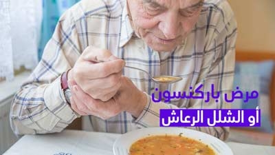 مرض باركنسون أو الشلل الرعاش