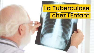 La Tuberculose chez l