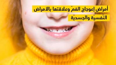 أمراض إعوجاج الفمّ وعلاقتها بالأمراض النّفسيّة والجسديّة