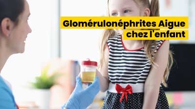  Glomérulonéphrites Aigue chez l'enfant