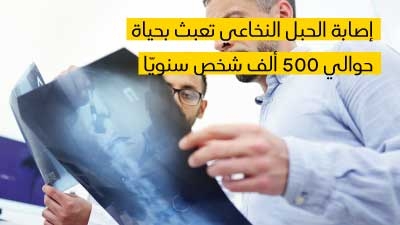 إصابة الحبل النخاعي تعبث بحياة حوالي 500 ألف شخص سنويّا