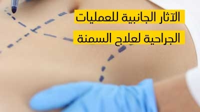 الآثار الجانبية للعمليات الجراحية لعلاج السمنة 