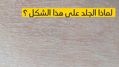   لماذا الجلد على هذا الشكل ؟