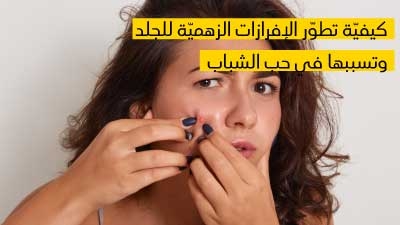  كيفيّة تطوّر الإفرازات  الزهميّة للجلد  وتسببها في حب الشباب