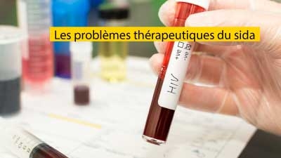 Les problèmes thérapeutiques du sida