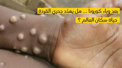 بعد وباء كورونا ... هل يهدّد جدري القردة حياة سكّان العالم ؟