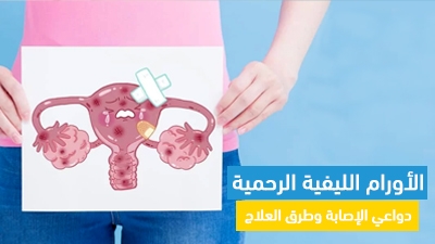 الأورام الليفية الرحمية: دواعي الإصابة وطرق العلاج