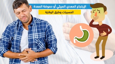 الإرتجاع المعدي المريئي أو حموضة المعدة: المسببات وطرق الوقاية