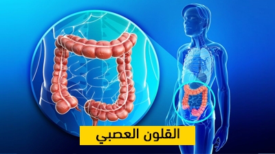 القولون العصبي