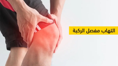 التهاب مفصل الركبة