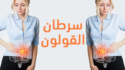 سرطان القولون