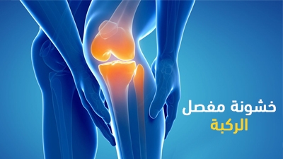 خشونة مفصل الركبة