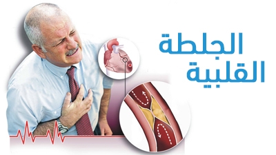 الجلطة القلبية