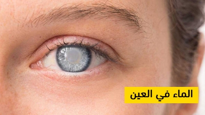 الماء في العين