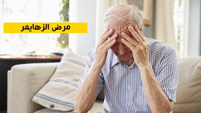 مرض الزهايمر