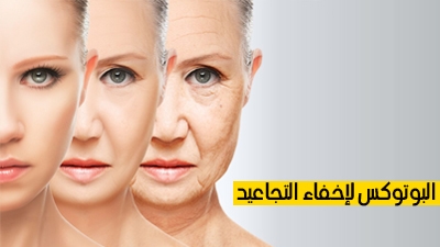 البوتوكس لإخفاء التجاعيد
