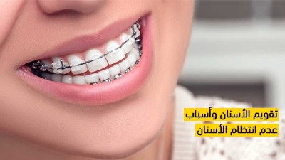 تقويم الأسنان وأسباب عدم انتظام الأسنان