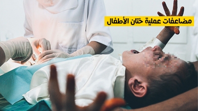 مضاعفات عملية ختان الأطفال