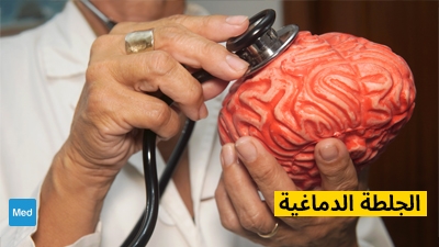 الجلطة الدماغية