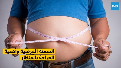 السمنة المرضية وأهمية الجراحة بالمنظار