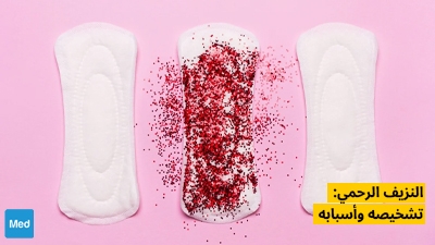 النزيف الرحمي: تشخيصه وأسبابه