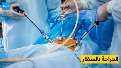 الجراحة بالمنظار