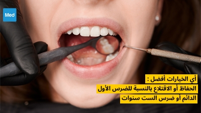 أي الخيارات أفضل : الحفاظ أو الاقتلاع بالنسبة للضرس الأول الدائم أو ضرس الست سنوات