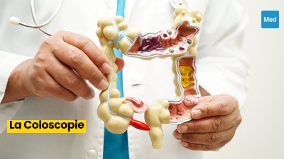 La Coloscopie : Un Outil Puissant dans la Prévention du Cancer Colorectal