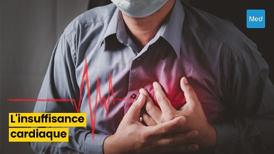 Tout ce que vous devez savoir sur l