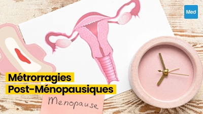 Métrorragies Post-Ménopausiques : Les Signaux d'Alerte Importants